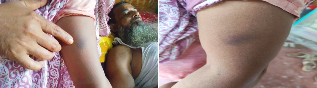 সরিষাবাড়ীতে সংরক্ষিত নারী সদস্য ও স্বামীর ওপর হামলার অভিযোগ